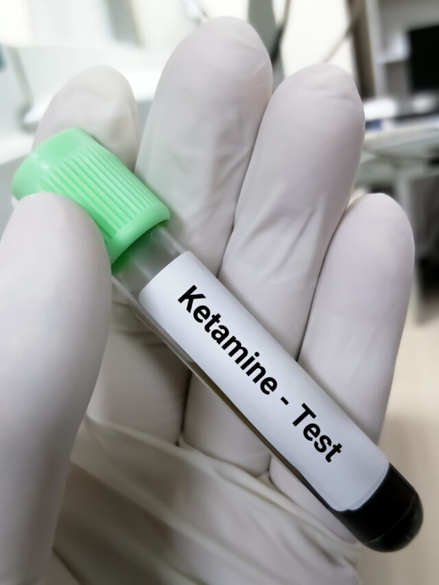 blood-sample-ketamine-test-medical-laboratory